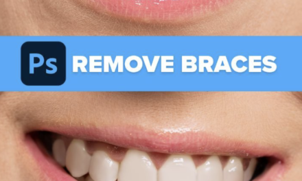 Remove Braces